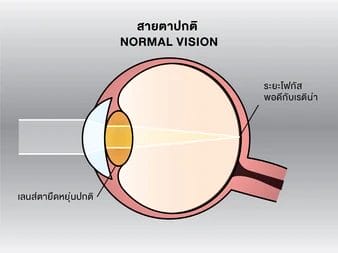สายตาปกติ